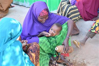 旱災導致患嚴重急性營養不良的索馬利兒童大幅增加