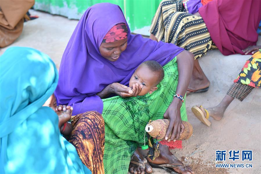（國際）（1）旱災導致患嚴重急性營養不良的索馬利兒童大幅增加