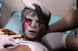 在巴以衝突中掙扎的孩子們（組圖）