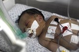 加沙：醫生為死去孕婦剖腹産 救出孩子(組圖)