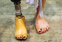 日本橫濱攝影器材展 女性佩戴假肢走秀引關注(組圖)