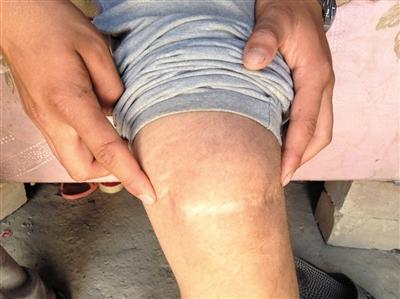 新疆被拐少年:7岁被拐到广东 每天要偷够1万