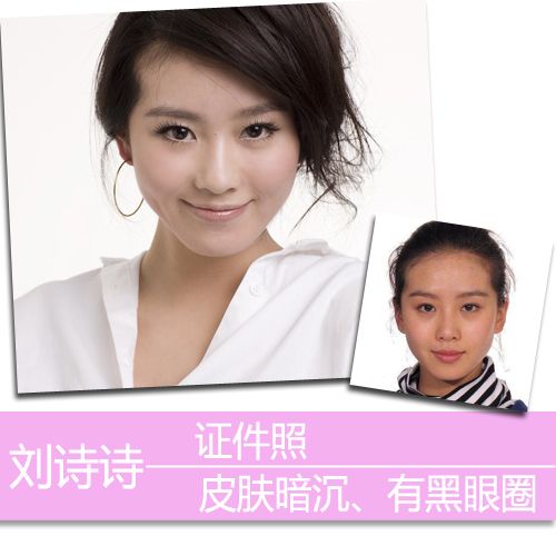 宋茜吴昕色斑多 证件照曝女星肌肤真相