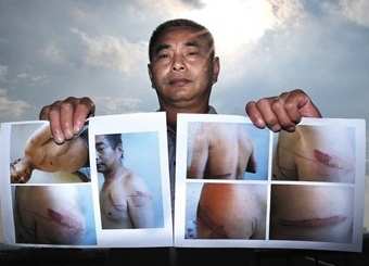 北京黑监狱截访案开审 访民曾被烧红铁钳烙身