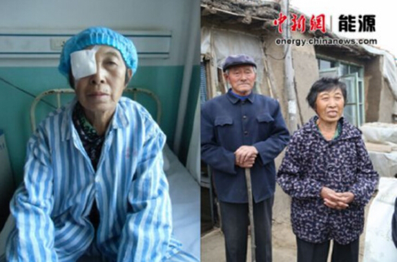&ldquo;中石化健康快车&rdquo;救活了我的一只眼