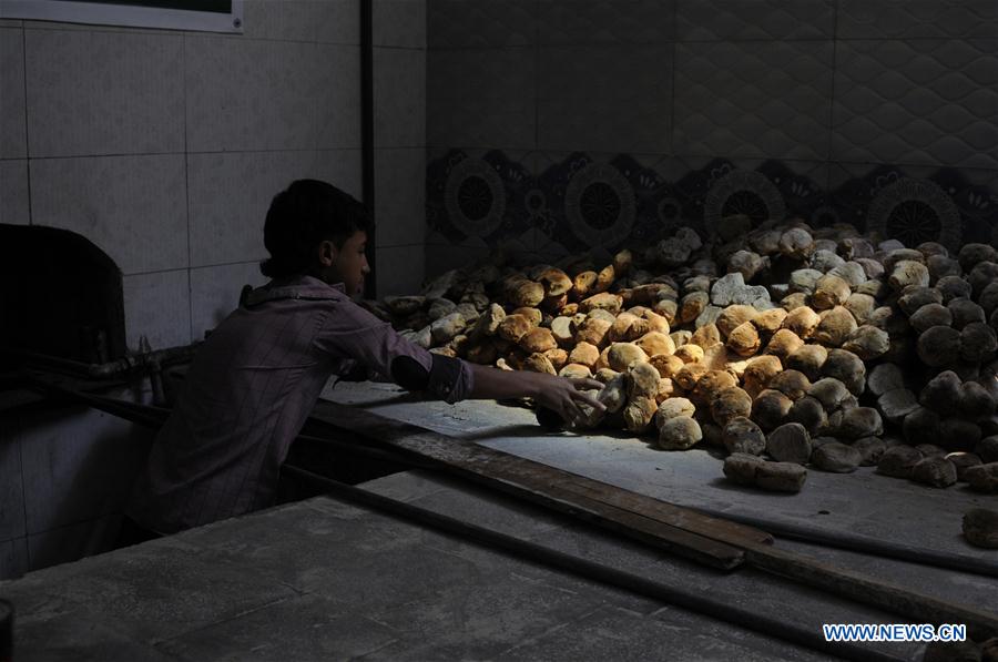 YEMEN-SANAA-FOOD INSECURITY