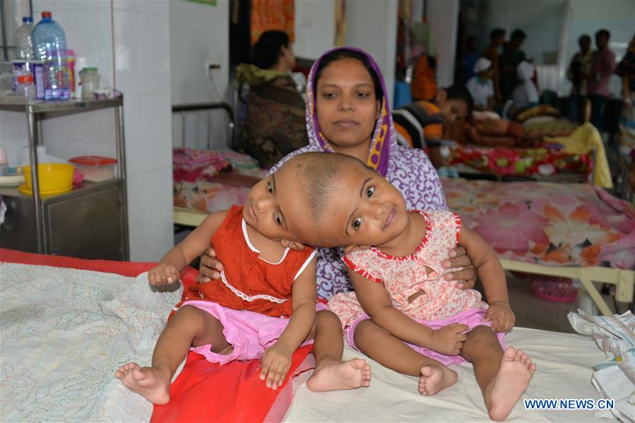 BANGLADESH-DHAKA-TWINS-CONNECTED