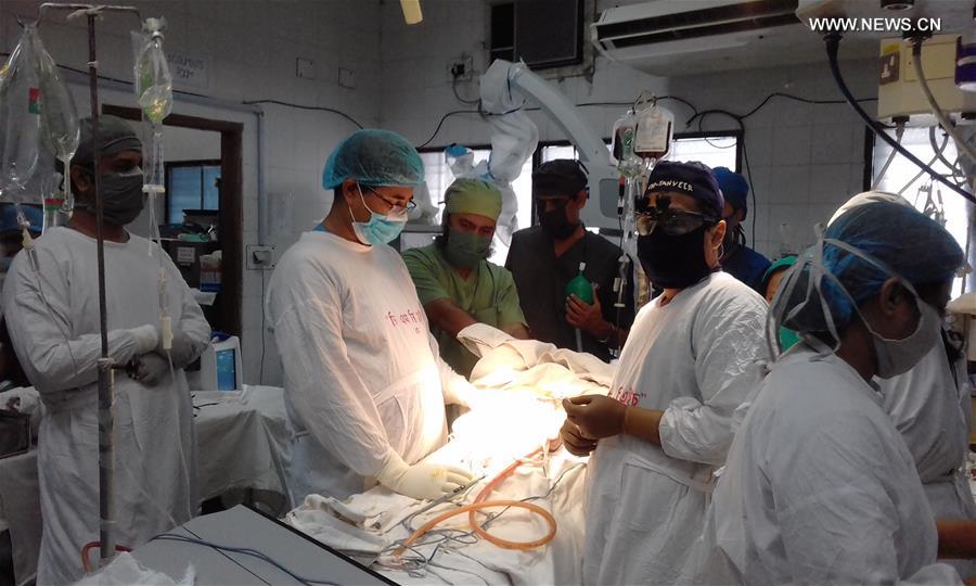 BANGLADESH-DHAKA-PYGOPAGUS-TWINS-SURGERY