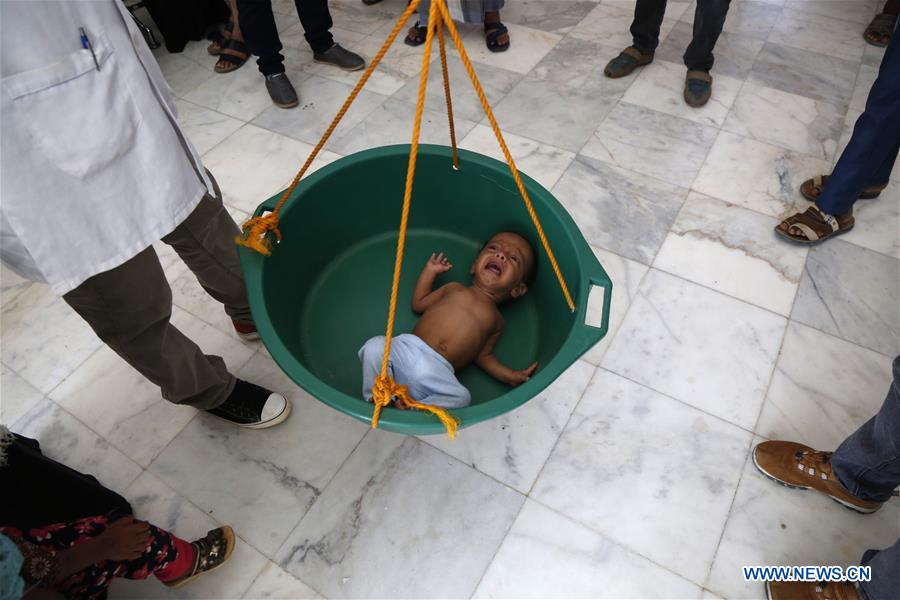 YEMEN-HAJJAH PROVINCE-FAMINE-CHILDREN