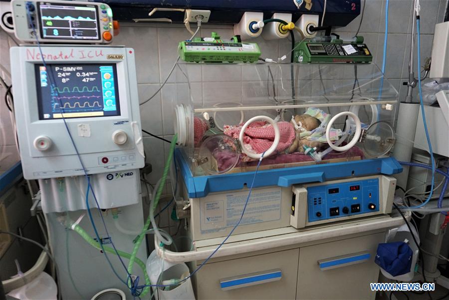 YEMEN-SANAA-CONJOINED TWINS-DEATH