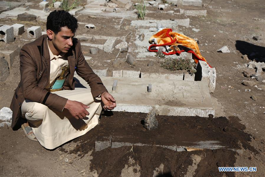 YEMEN-SANAA-CONJOINED TWINS-BURIAL