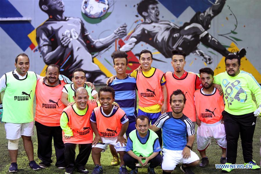 (SP)EGYPT-ALEXANDRIA-FOOTBALL TEAM-PEOPLE SUFFERING FROM DWARFISM