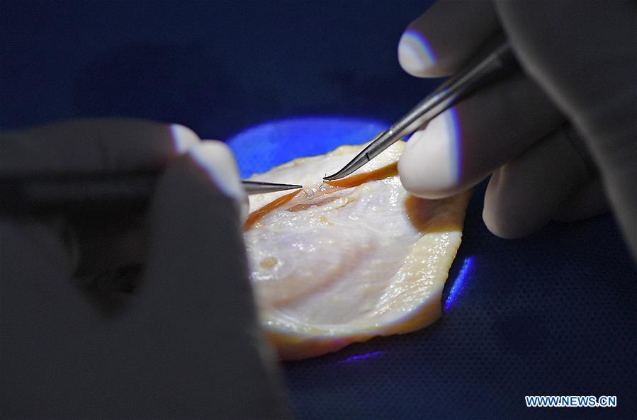 CHINA-NANCHANG-SURGEON-SKILL DEMONSTRATION (CN)