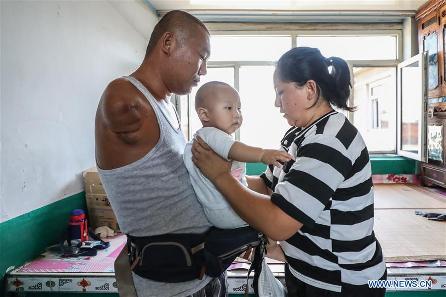 CHINA-LIAONING-CHANGTU-ARMLESS FATHER (CN)