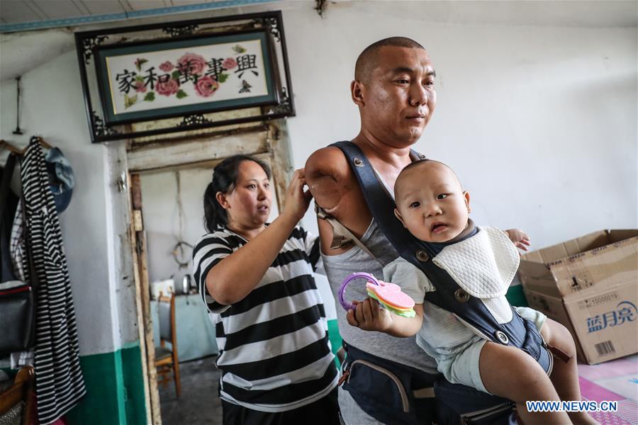 CHINA-LIAONING-CHANGTU-ARMLESS FATHER (CN)