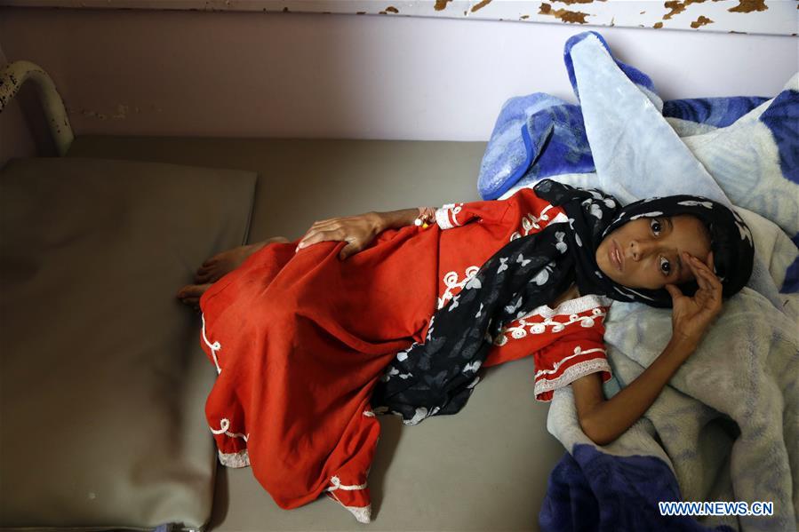 YEMEN-SANAA-HUNGER-CHILDREN