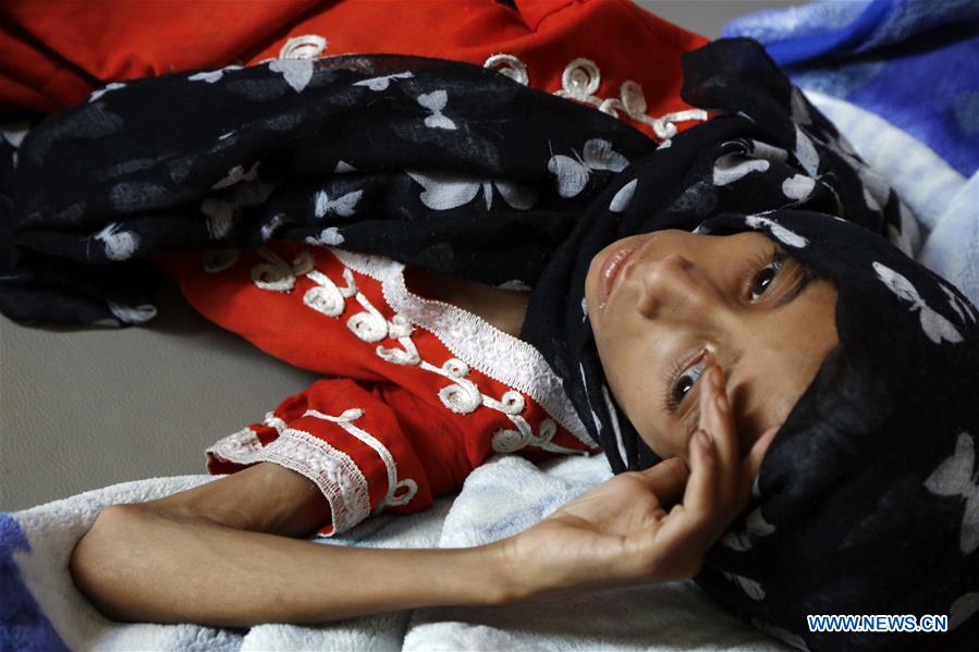 YEMEN-SANAA-HUNGER-CHILDREN