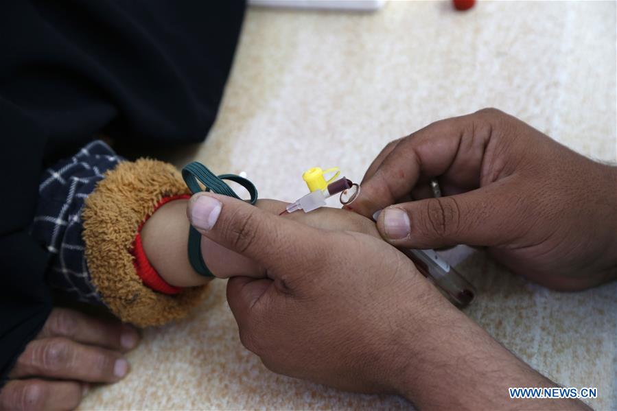 YEMEN-SANAA-MALNUTRITION-CHILDREN