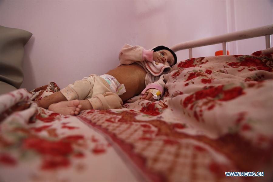 YEMEN-SANAA-HEALTH EMERGENCY-EPIDEMICS