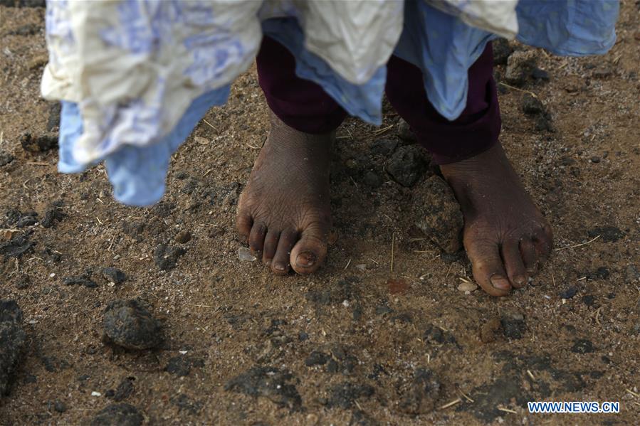 YEMEN-SANAA-DISPLACED PEOPLE