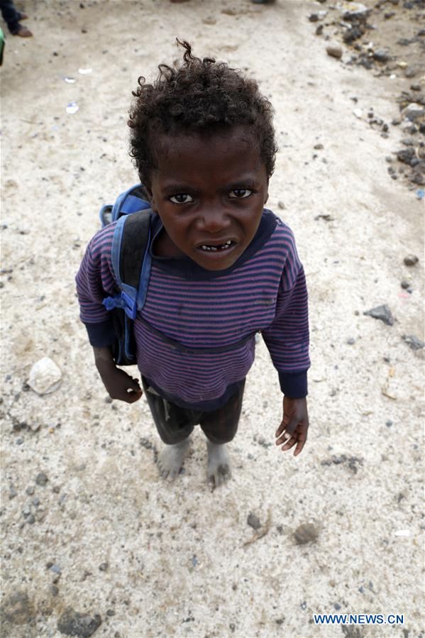 YEMEN-SANAA-DISPLACED PEOPLE