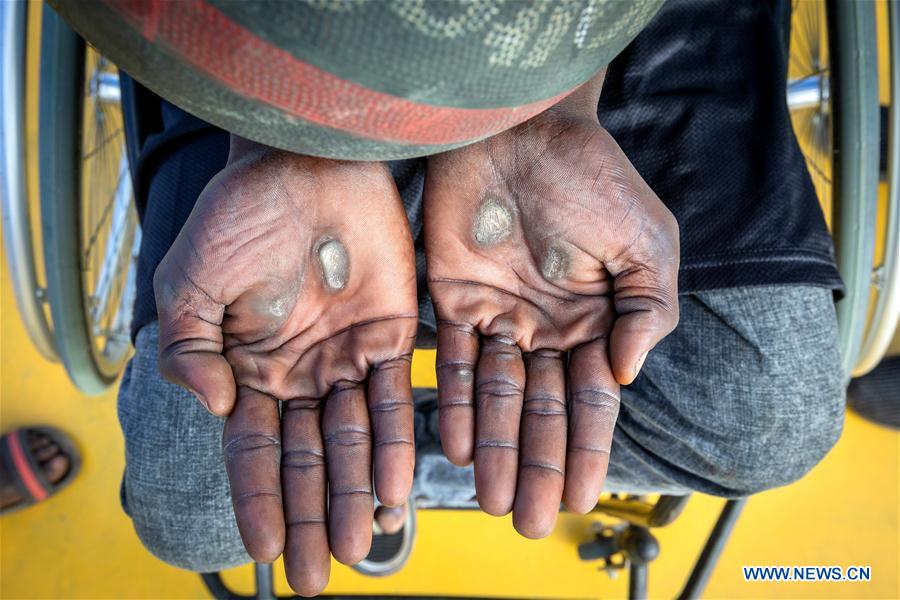 SOUTH SUDAN-JUBA-WHEELCHAIR AMPUTEES-BASKETBALL