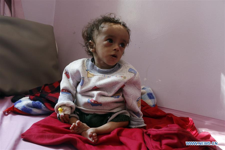 YEMEN-SANAA-CHILDREN