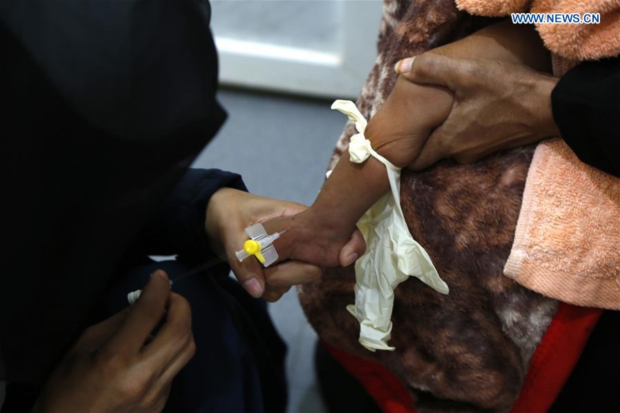 YEMEN-SANAA-CHILDREN-MALNUTRITION-HUMANITARIAN ASSISTANCE 