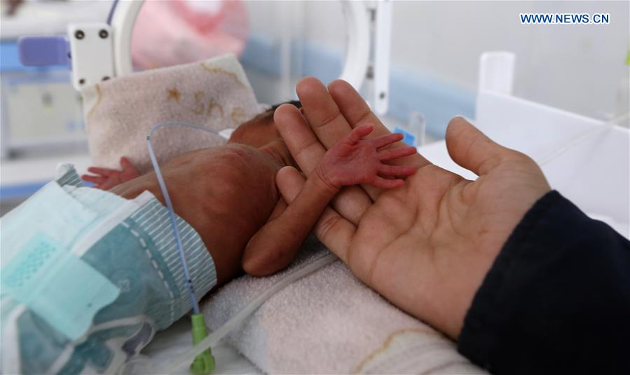 YEMEN-SANAA-CHILDREN-MALNUTRITION-HUMANITARIAN ASSISTANCE