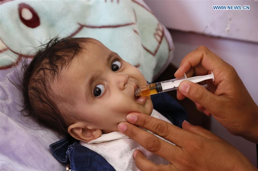 YEMEN-SANAA-CHILDREN-MALNUTRITION-HUMANITARIAN ASSISTANCE