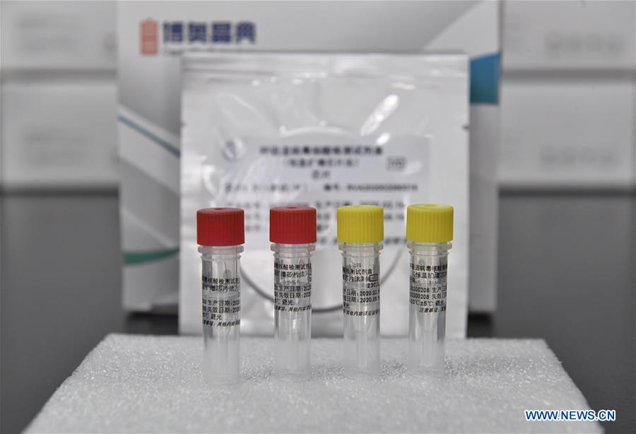 CHINA-SICHUAN-COVID-19-NUCLEIC ACID TEST CHIP (CN)