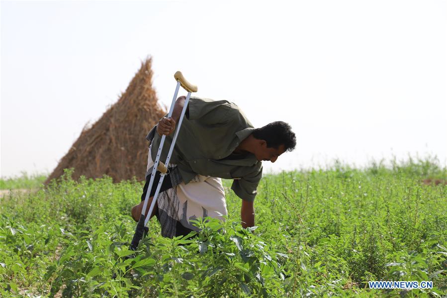 YEMEN-HAJJAH-WAR-LANDMINE VICTIMS