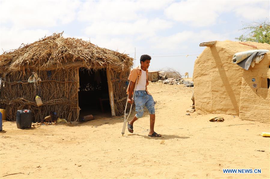 YEMEN-HAJJAH-WAR-LANDMINE VICTIMS