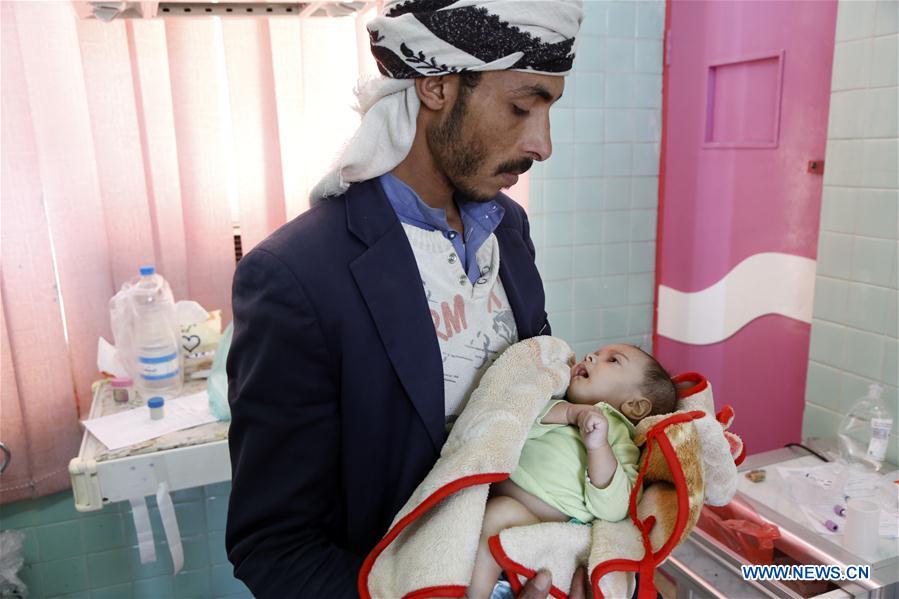 YEMEN-SANAA-CHILDREN-MALNUTRITION