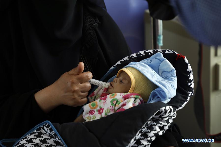 YEMEN-SANAA-CHILDREN-MALNUTRITION