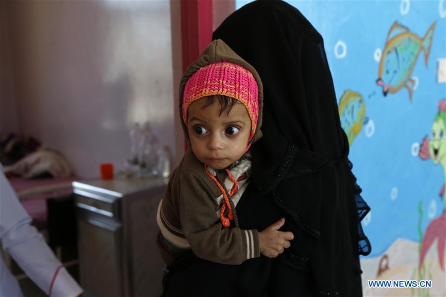 YEMEN-SANAA-CHILDREN-MALNUTRITION