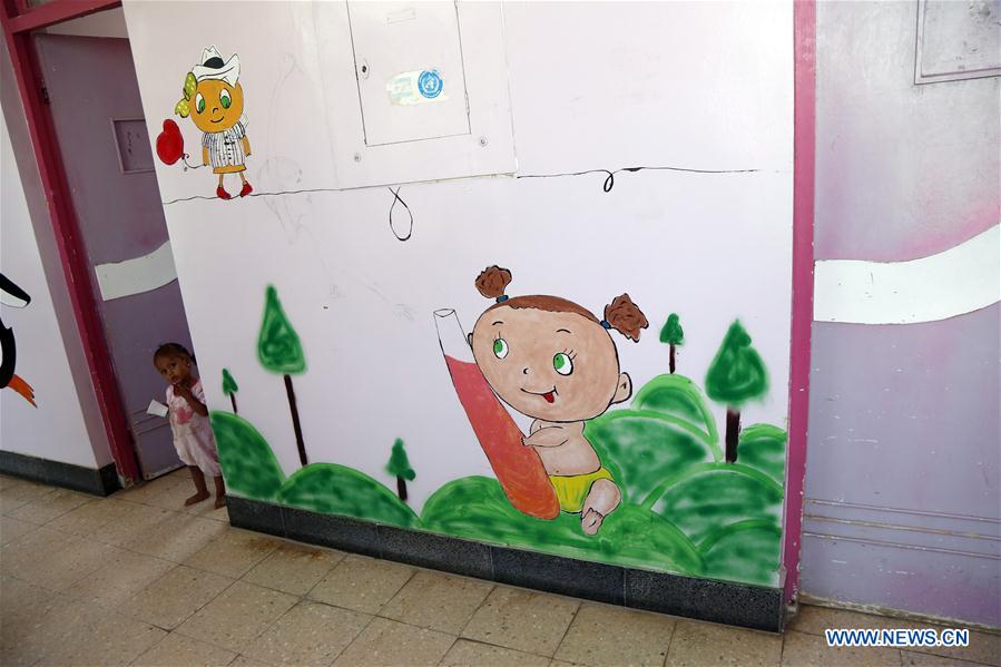 YEMEN-SANAA-CHILDREN-MALNUTRITION