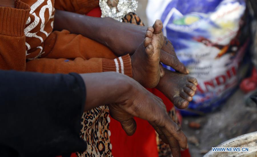 YEMEN-SANAA-DISPLACED PEOPLE
