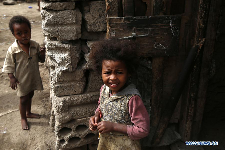 YEMEN-SANAA-WAR-AFFECTED CHILDREN