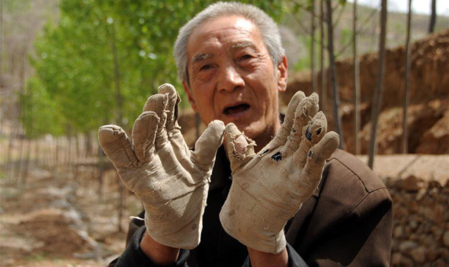 Pic story: handicapped veteran plants trees on barren mountains for years in Hebei