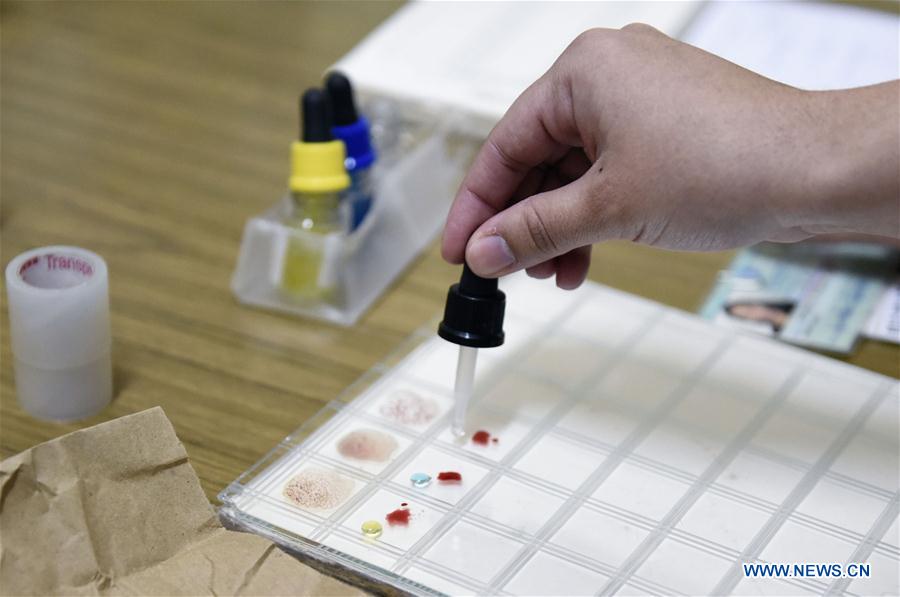 Photo taken on June 9, 2016 shows Lilian Garcia, a hemotherapy technician, doing tests on donor blood samples in Montevideo, capital of Uruguay Photo taken on June 9, 2016 shows Lilian Garcia, a hemotherapy technician, doing tests on donor blood samples in Montevideo, capital of Uruguay