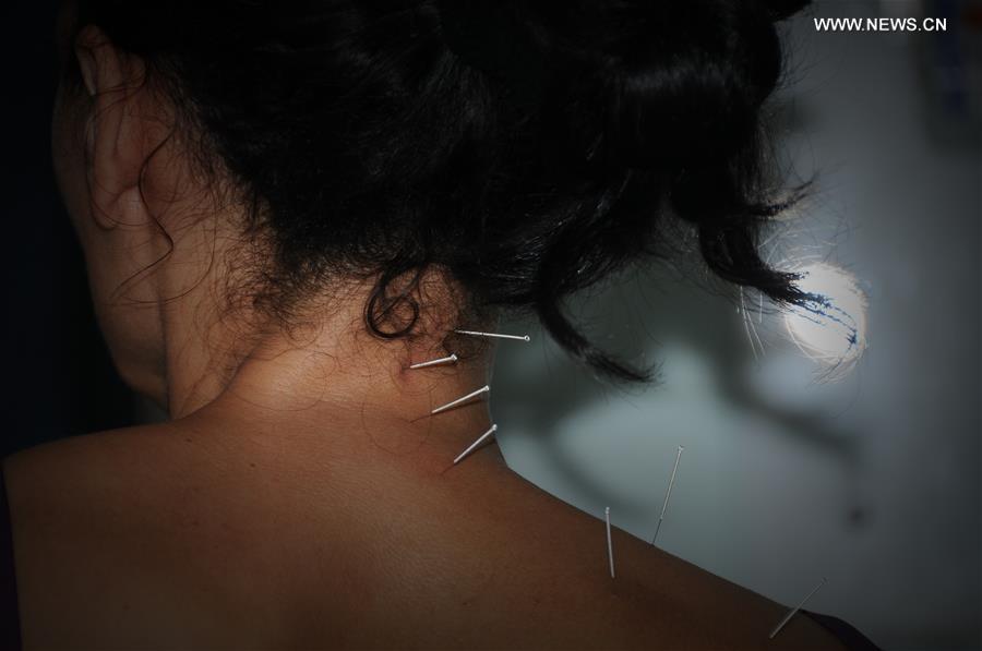 CHINA-TRADITIONAL MEDICINE-ACUPUNCTURE THERAPY (CN)