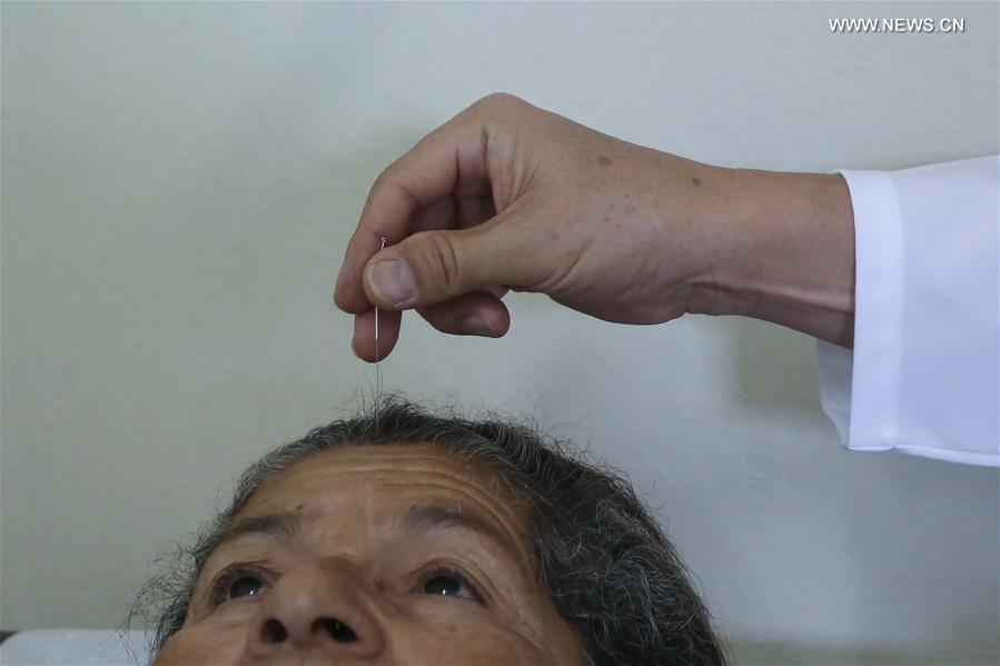 CHINA-TRADITIONAL MEDICINE-ACUPUNCTURE THERAPY (CN)