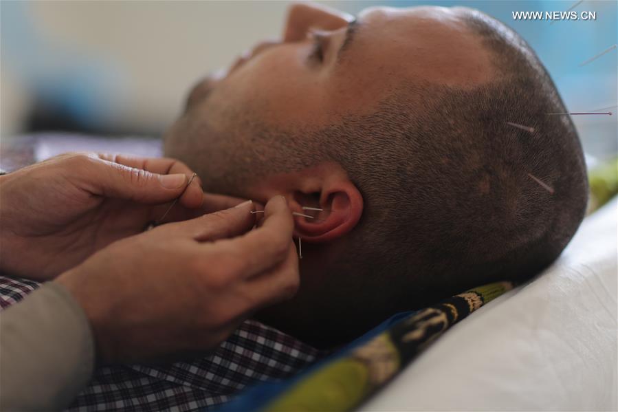 CHINA-TRADITIONAL MEDICINE-ACUPUNCTURE THERAPY (CN)