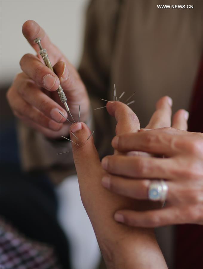 CHINA-TRADITIONAL MEDICINE-ACUPUNCTURE THERAPY (CN)