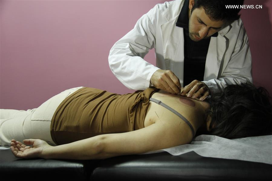 CHINA-TRADITIONAL MEDICINE-ACUPUNCTURE THERAPY (CN)