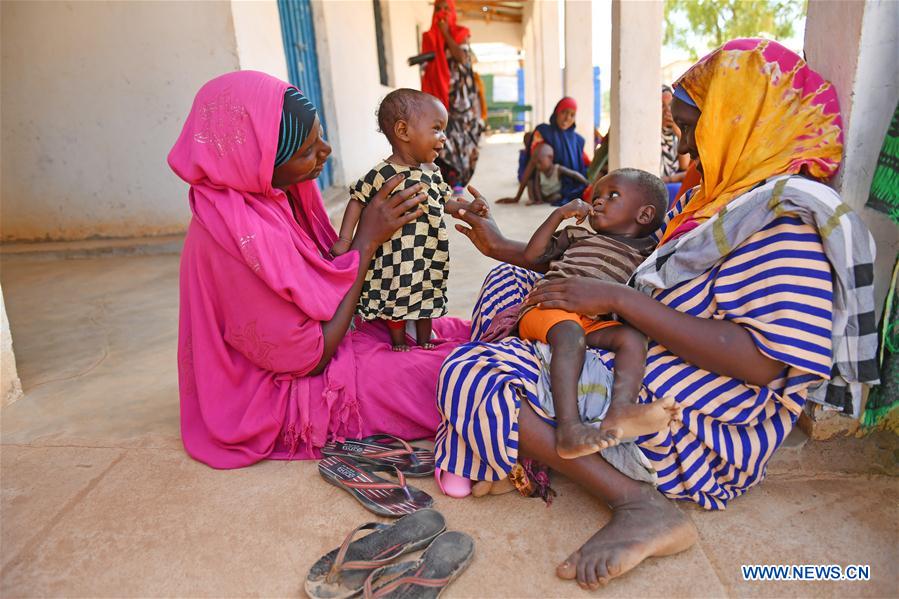 SOMALIA-DOOLOW-CHILDREN-MALNUTRITION