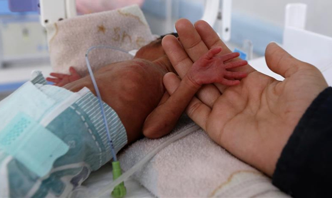 Children accept treatment for malnutrition in Sanaa, Yemen
