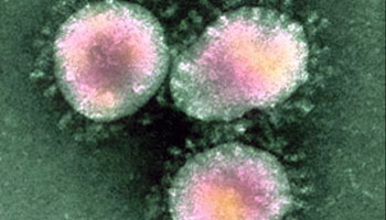 New coronavirus outbreak causes uneasiness: experts respond