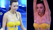Model Zhou Weitong suspected of getting boob job